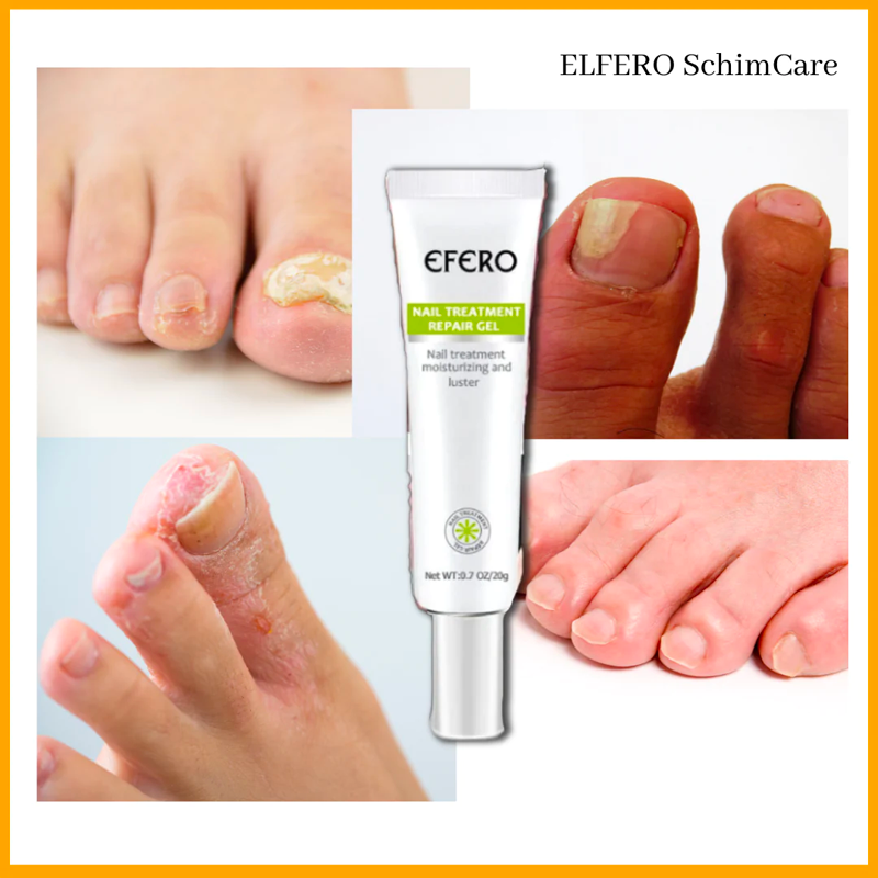 Efero SchimCare | Anti-Fungus Nail Treatment Gel